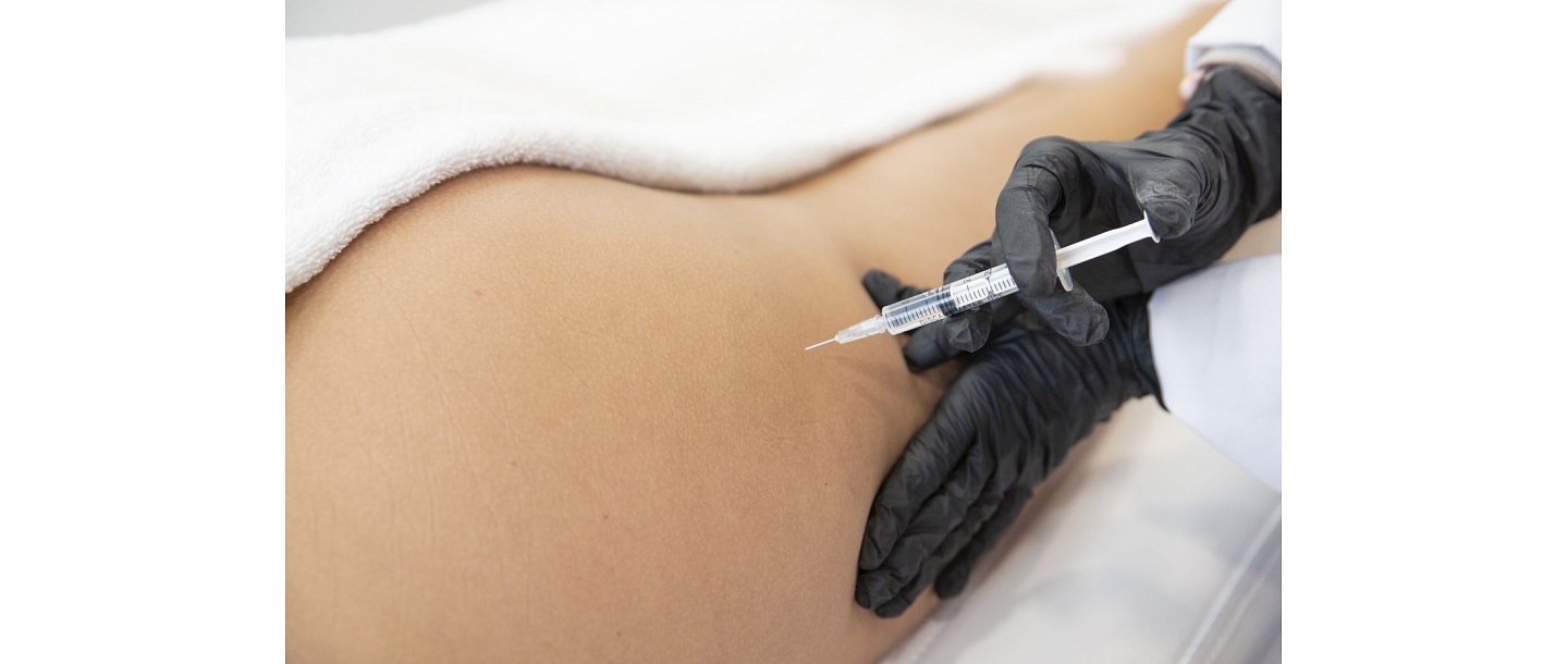 Lipolytic injections