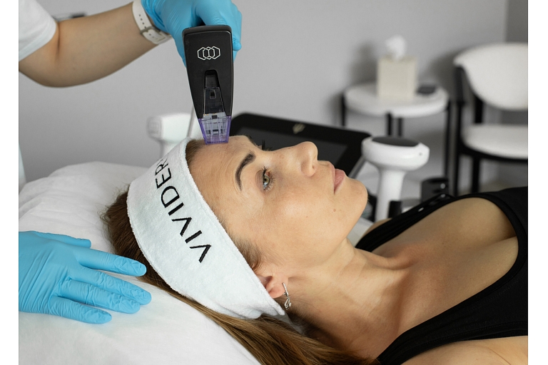 Morpheus 8 Fractional RF lifting