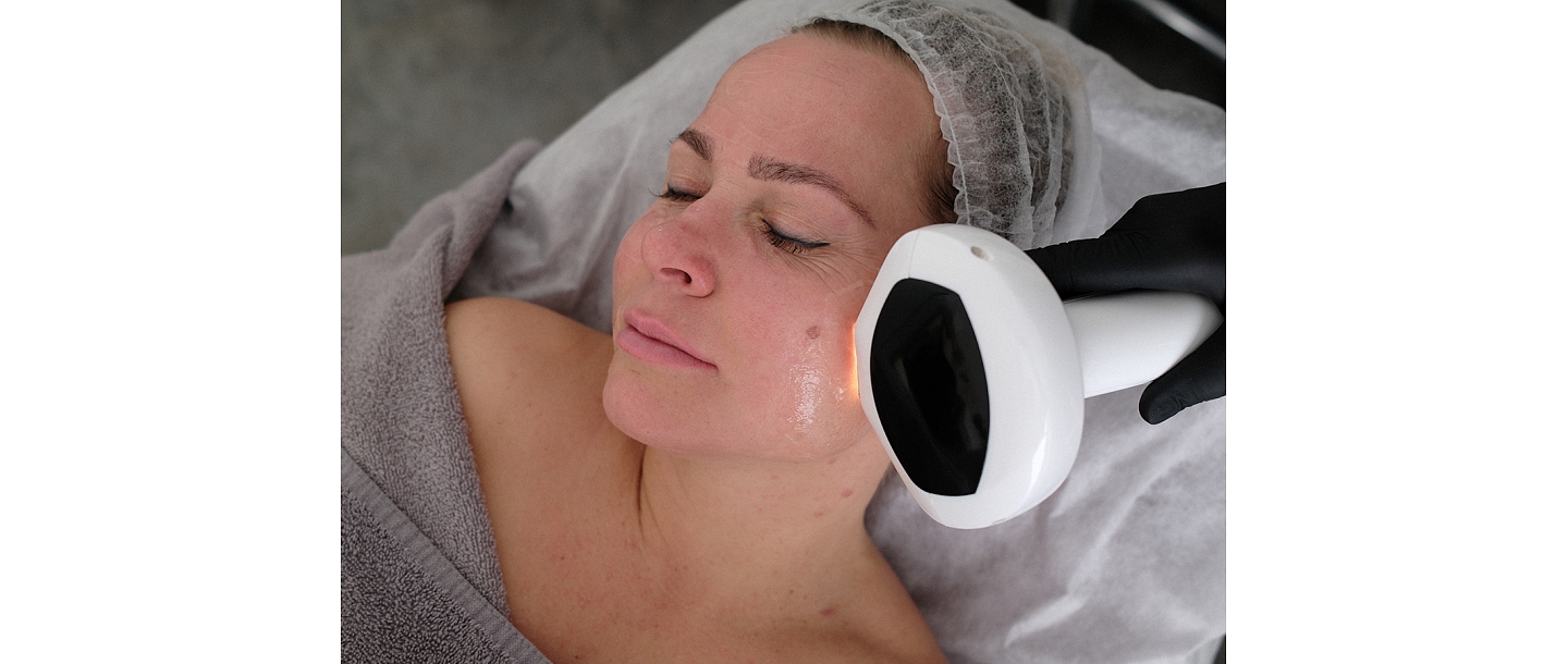 Innovative device procedure for facial skin rejuvenation and improvement. The procedure is painless, effective and suitable for solving various skin problems, promoting skin radiance and elasticity.