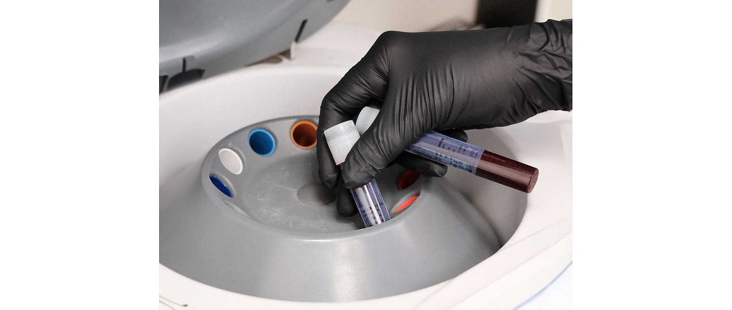 Accurate and sterile blood sample processing, which is essential for providing high-quality aesthetic and restorative procedures.