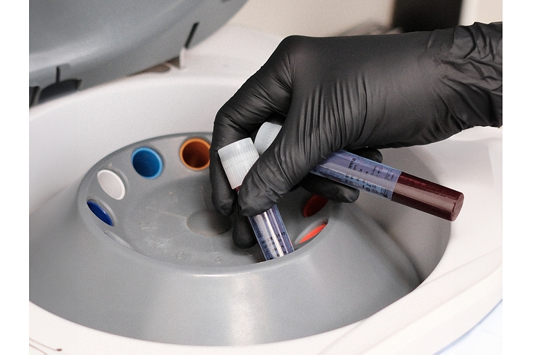 Accurate and sterile blood sample processing, which is essential for providing high-quality aesthetic and restorative procedures.