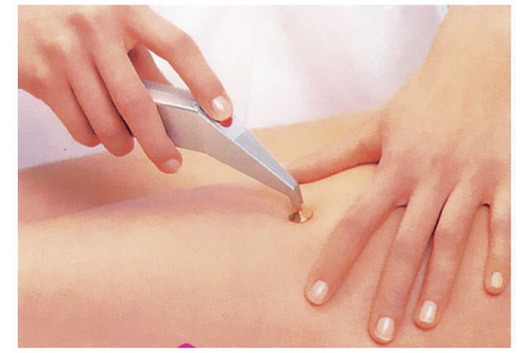 Skin photo rejuvenation