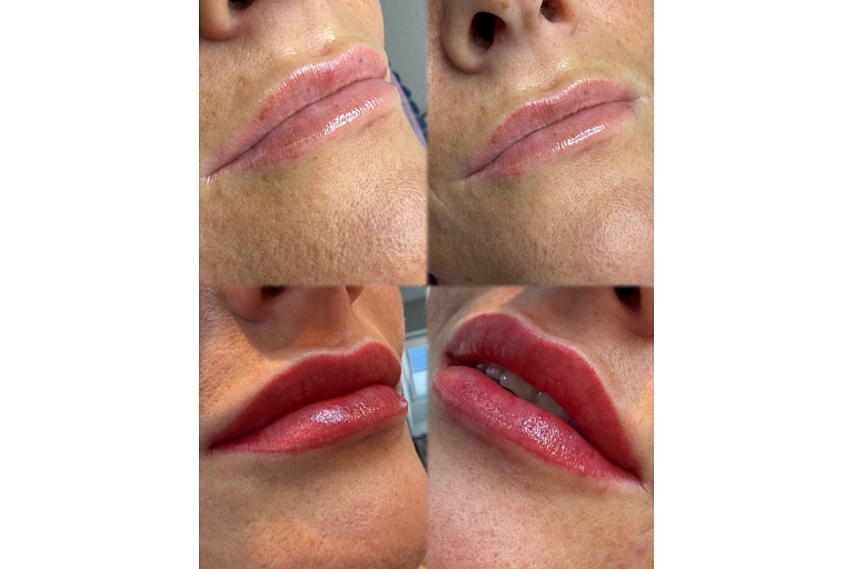 Перманентный макияж для губ