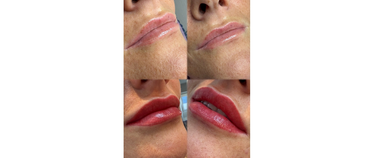 Permanent makeup for lips