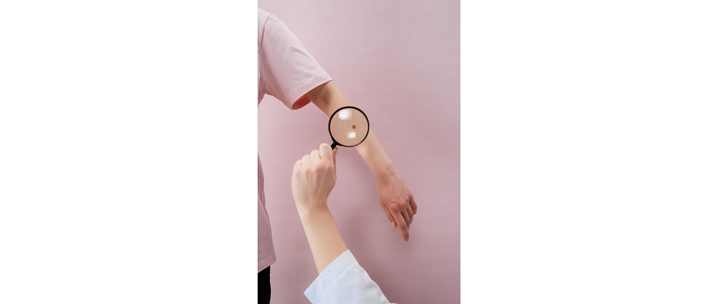 Examination of moles