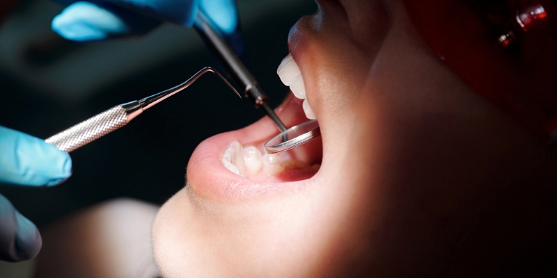 Гигиена зубов