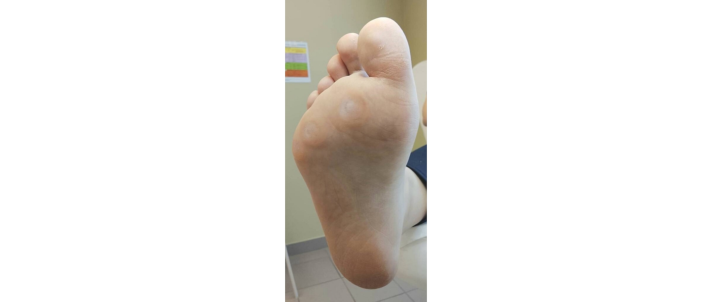 Diabetic foot care