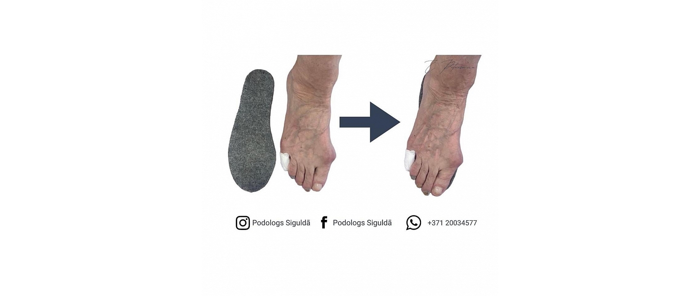 Частная практика ортопеда Элины Путрашевицы 