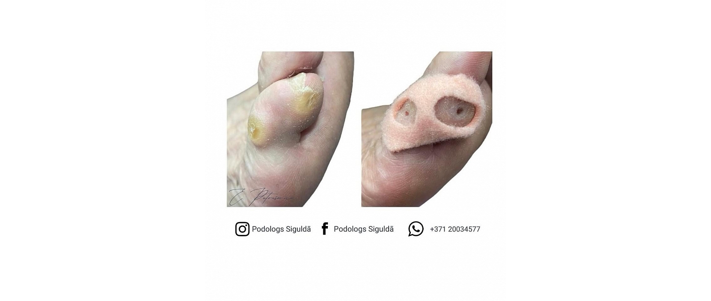 Частная практика ортопеда Элины Путрашевицы 