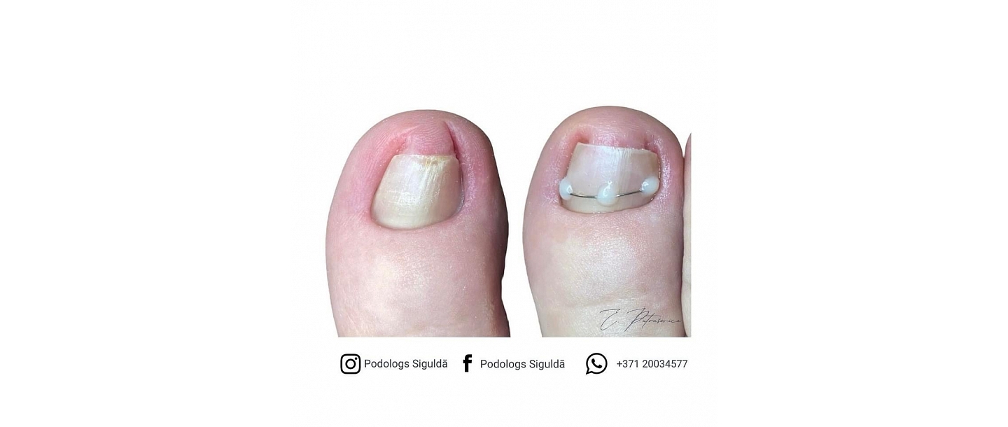 Частная практика ортопеда Элины Путрашевицы 