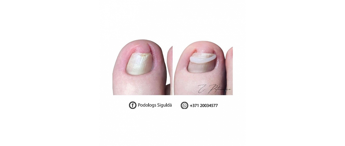 Elīnas Putraševicas Podologa privātprakse 