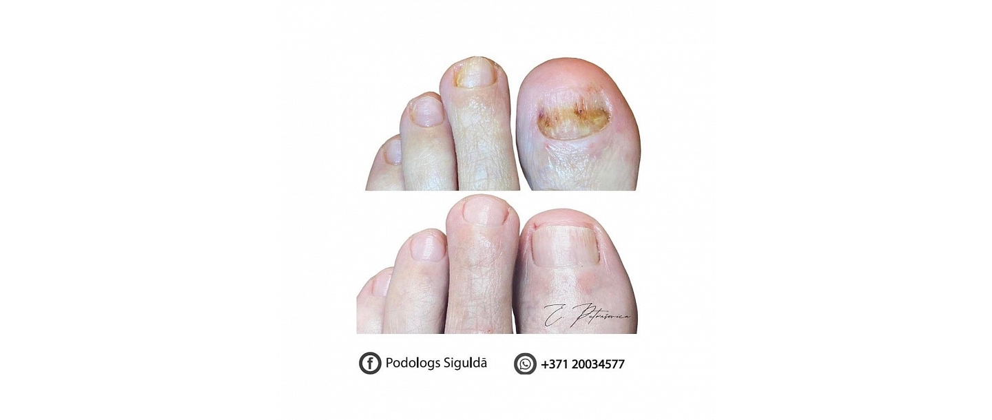 Elīnas Putraševicas Podologa privātprakse 