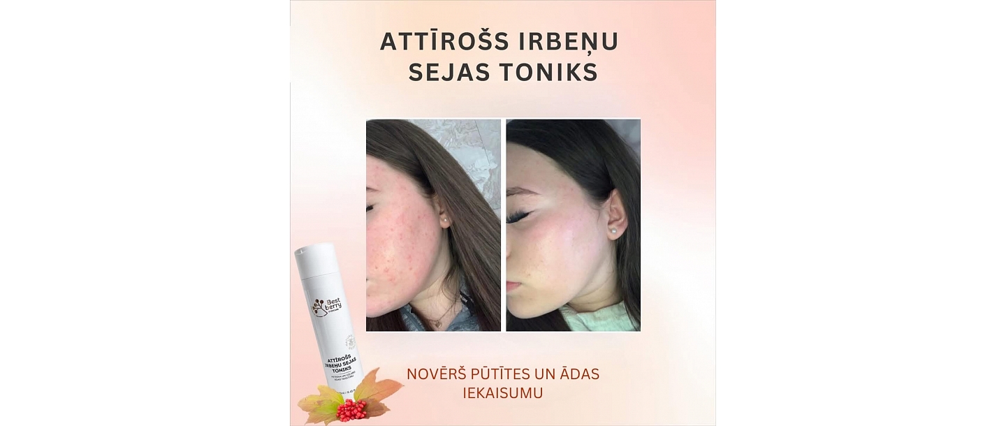 Attīrošs irbeņu sejas toniks