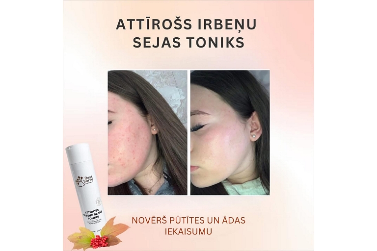 Purifying partridge facial toner