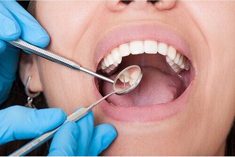 Assessment  of the oral cavity