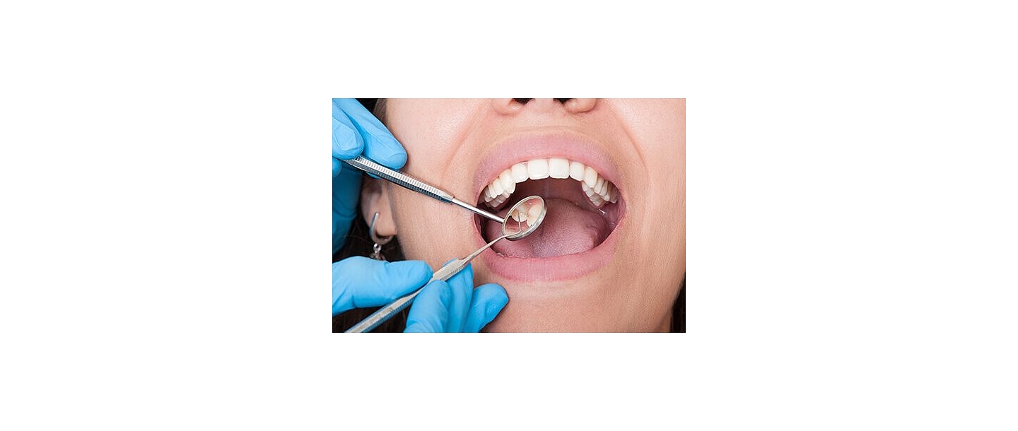 Assessment  of the oral cavity