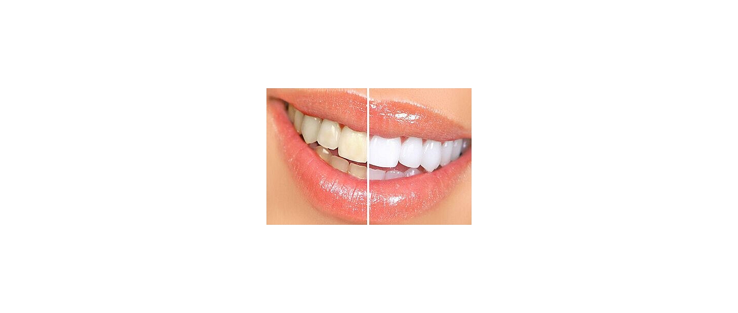 Lectures on dental care