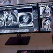 Kas jāzina par magnētiskās rezonanses izmeklējumu