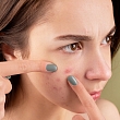 Dermatologist