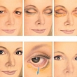 Plastic surgery