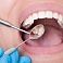 Dental hygienist services in Tukums