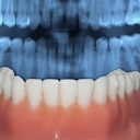 Ortodontija (sakodiena labošana)