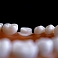 Dentistry and oral hygiene