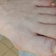 Ieaugušu nagu korekcija